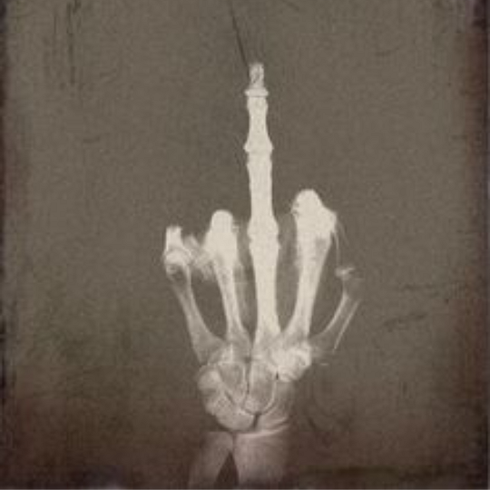 xray middle finger