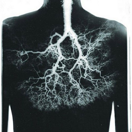 lungs on an ex-ray